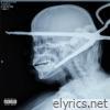 x-ray - Single