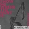 Show Me Where the Hurt Is: Songs